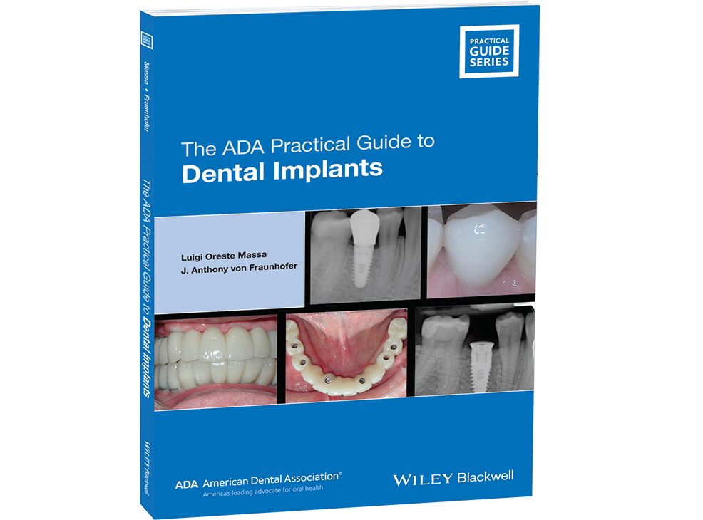 The ADA Practical Guide to Dental Implants Image 0